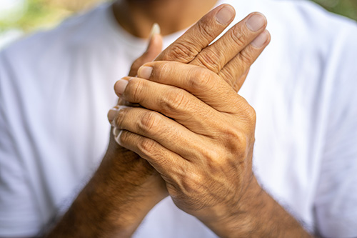 arthritis Older man rubbing hands together to relieve arthritis pain
