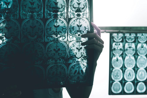 Doctor reviewing brain scans